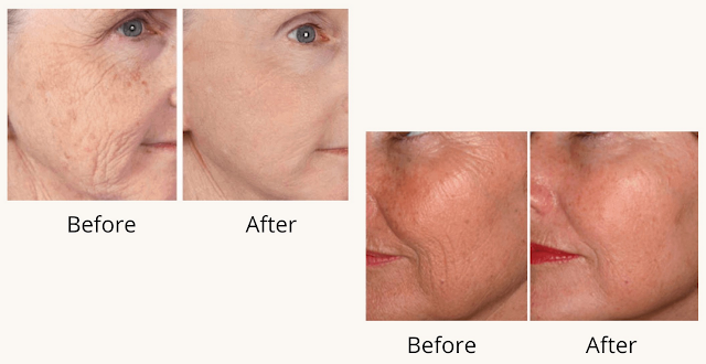 Hydrossential Result